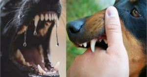 Dog Bite Compensation